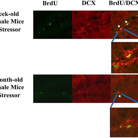 Representative Photomicrographs Of The Brdu Green Dcx Red And