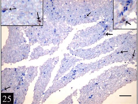 A Photomicrograph Of A Section In Rat Sciatic Nerve From The