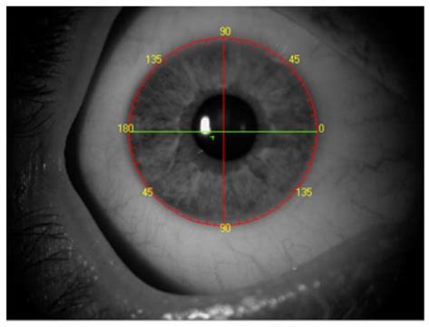 Comparison of INTEGRA and the Manual Method to Determine the Axis for