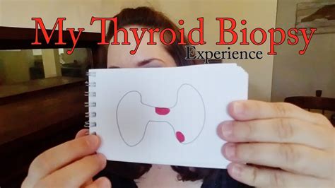 {my Thyroid Biopsy} Experience Youtube