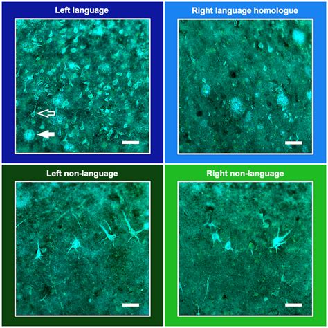 Representative Photomicrographs Of The Differential Distributions Of