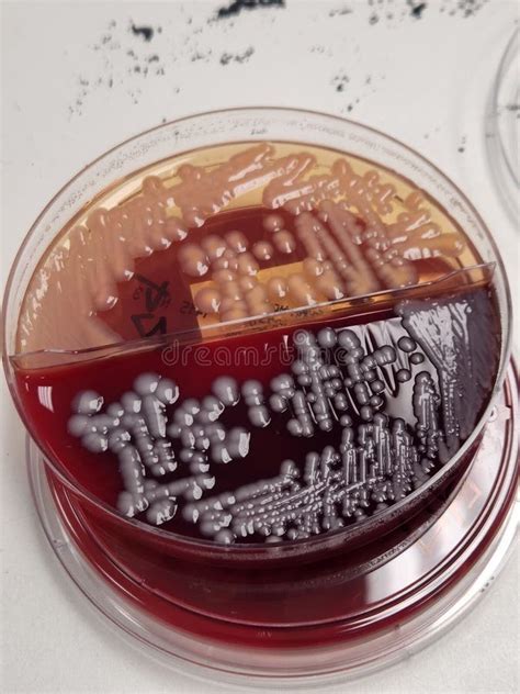 Klebsiella Pneumoniae Emb