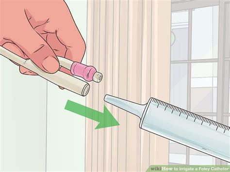 How to Irrigate a Foley Catheter (with Pictures) - wikiHow