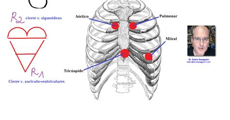 Auscultación cardíaca primero y segundo ruido Auscultacion cardiaca