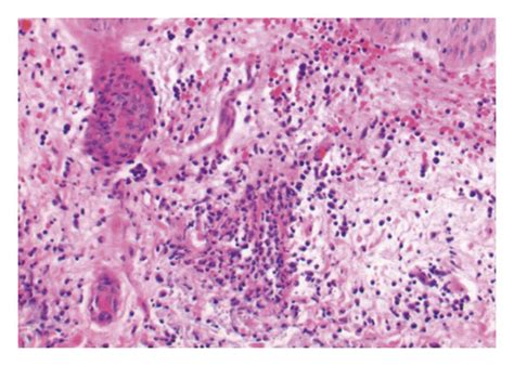 histology   hematoxylin eosin stain original magnifications