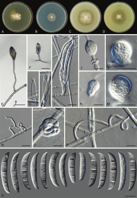 Fusarium Convolutans Sp Nov A D Colonies On Pda Sna Oa And Cma