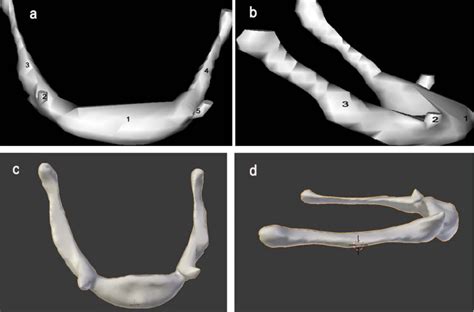 hyoid bone  anterior view  winsurf   side view