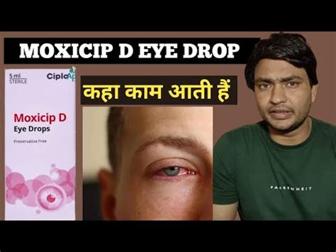 Moxicip D Eye Drop Use In Hindi Moxicip D Eye Drop Kish Kaam Aati Hai