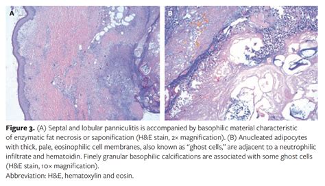 Saponification Histology