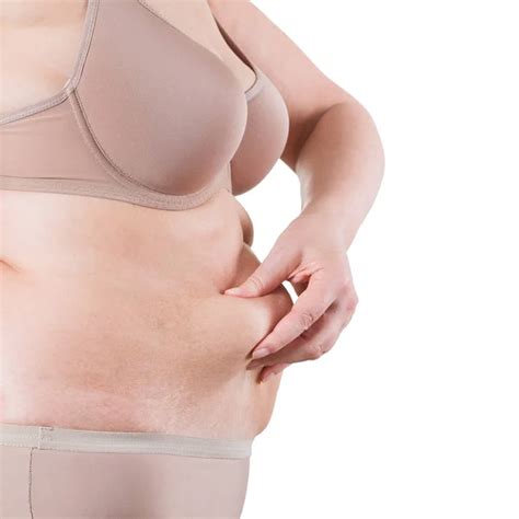 Saggy Tummy Stock Photos Royalty Free Saggy Tummy Images Depositphotos