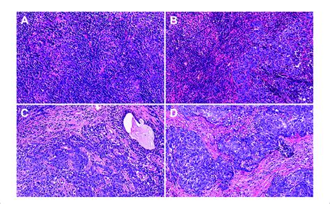 Representative Features Of Hematoxylin And Eosin Hande Stained Tumor Download Scientific