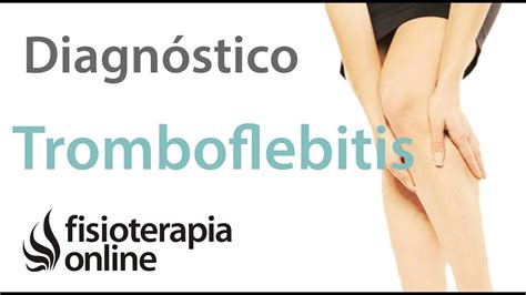 Cómo diferenciar una tromboflebitis de un dolor muscular de la