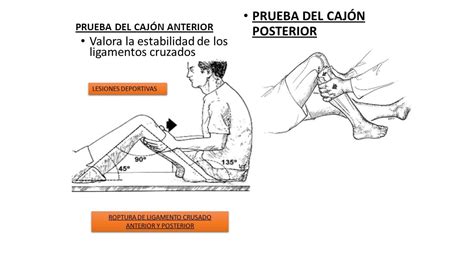 Presente H Lice Lento Prueba De Cajon Anterior De Tobillo Decoraci N