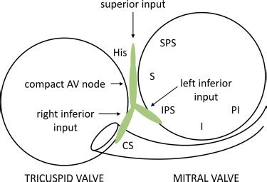 Catheter Ablation Via The Left Atrium For Atrioventricular Nodal