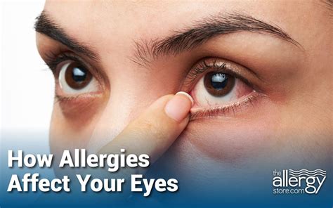 How Allergies Affect Your Eyes