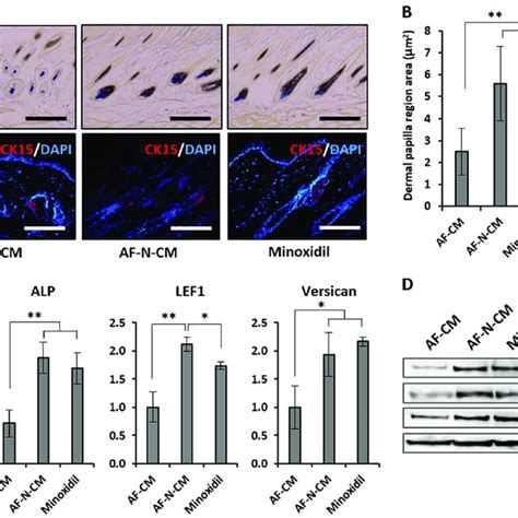 Histological Analysis Of Amniotic Fluid Derived Mesenchymal Stem Cell