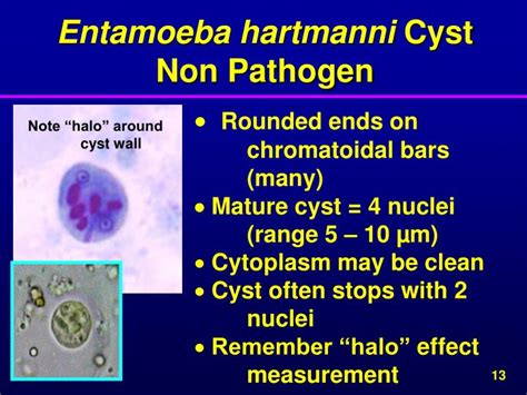 Ppt 2013 Parasitology Workshop Lynnegarcia2verizon Powerpoint Presentation Id2721956