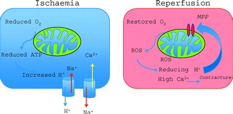 Fucoidan Effects On Cerebral Ischemia Reperfusion Injury Cancer And