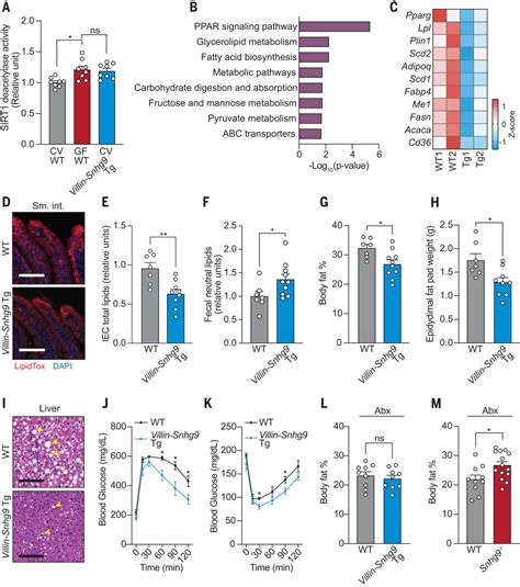 The Gut Microbiota Reprograms Intestinal Lipid Metabolism Through Long