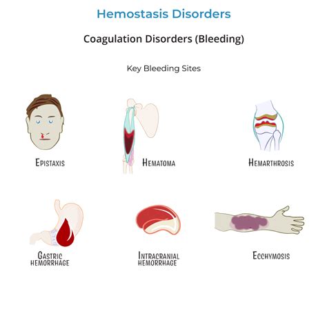 Clinical Pathology Glossary Coagulation Disorders Hemophilia