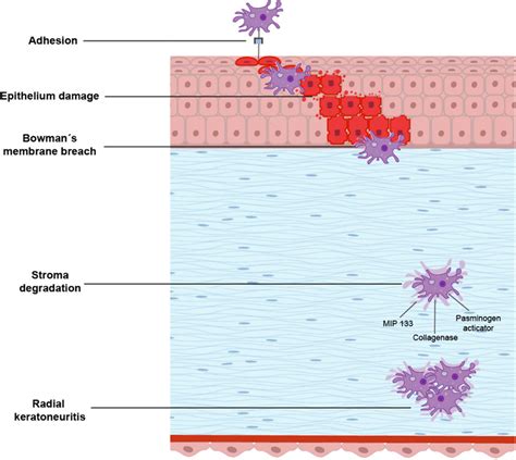 Pathophysiology Of Acanthamoeba Keratitis Download Scientific Diagram