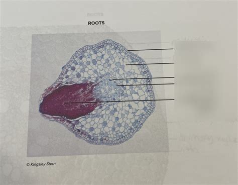 lateral root xs Diagram | Quizlet