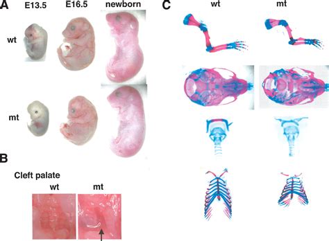 Interactions between Sox9 and β-catenin control chondrocyte differentiation 