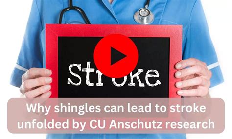 Why Shingles Can Lead To Stroke Unfolded By Cu Anschutz Research