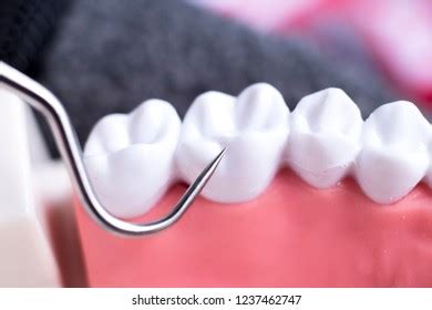 Dentist Cleaning Teeth Titanium Metal Tooth Stock Photo 1237462747 | Shutterstock