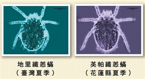 4月恙蟲病盛行 連假接觸草叢做好防護｜感染科｜科別｜元氣網