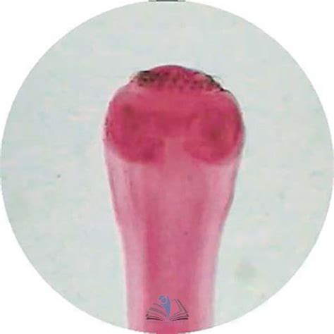 Prepared Microscope Slide - Tapeworm (Taenia) Proglottid T.S. Manufacturer, Prepared Microscope ...