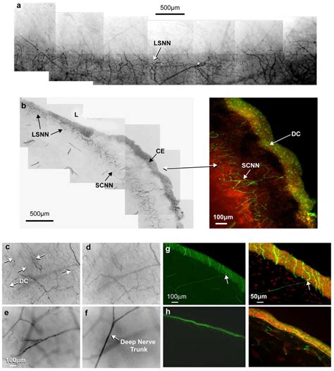 Origin Of Corneal Epithelial Nerves A Whole Mount View Of The Limbal