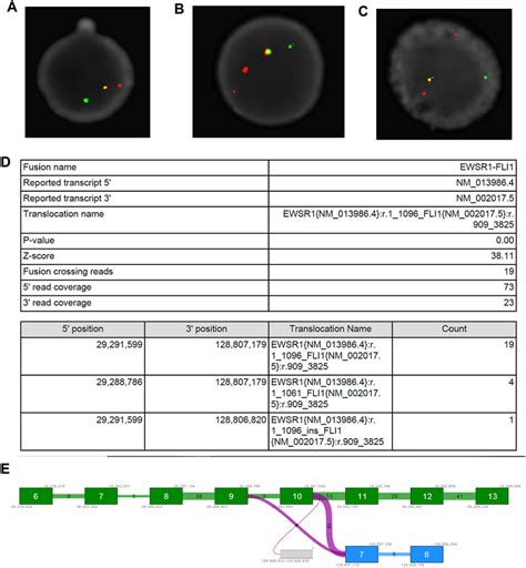 Identification of a previously uncharacterized EWS-FLI1 fusion ... 