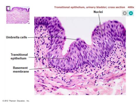 Transitional Epithelium Labeled 400x