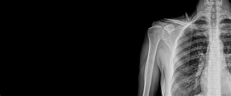 Wallpaper engine 18 xray обои