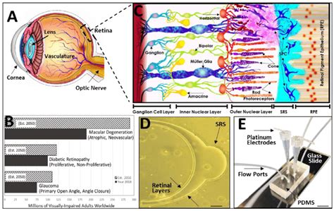 Cell Replacement Therapy To Treat Age Related Retinal Degeneration