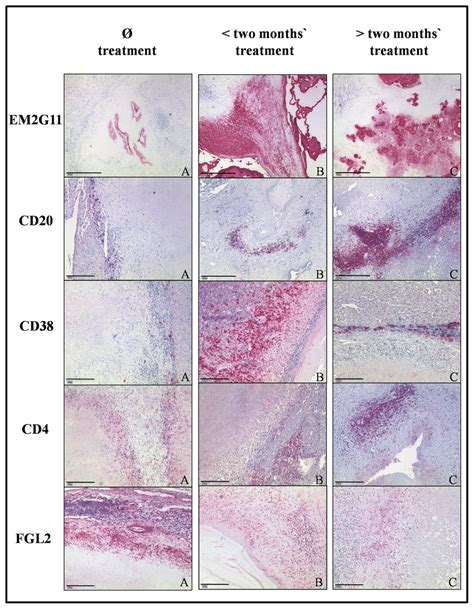 Immunohistochemical Analysis Of Sections Of Liver Tissue From Patients Download Scientific