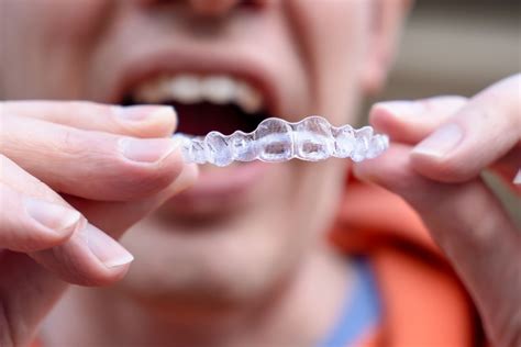 Choosing Between Invisalign And Braces Which Is Your Perfect Fit