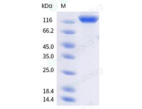 Recombinant Cynomolgus VEGFR2 KDR Protein 90907 C49H B Sino Biological