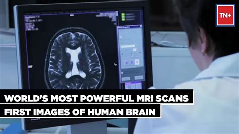 World S Most Powerful MRI Scans First Images Of Human Brain YouTube