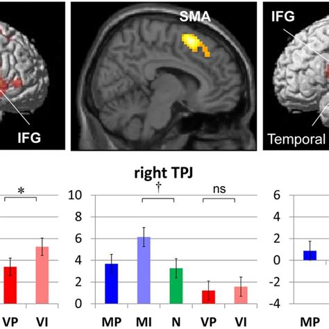 FMRI Results Regions That Showed A Significant Response To Contingency