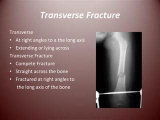 Transverse fracture presentation bio 120 | PPT