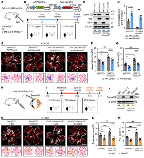 Endothelium Derived Semaphorin G Attenuates Ischemic Retinopathy By