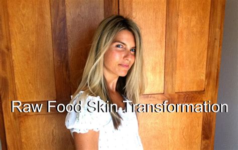 (VIDEO) Skin Transformation Through Raw Vegan Lifestyle - Raw Vegan Matters