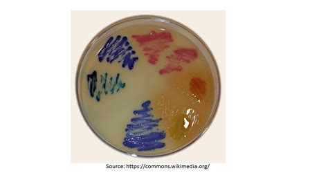 Chromogenic Uti Medium Introduction Principle Composition Preparatio