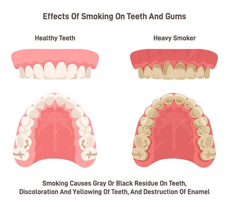 Premium Vector | Effects of smoking on teeth and gums Oral cavity of