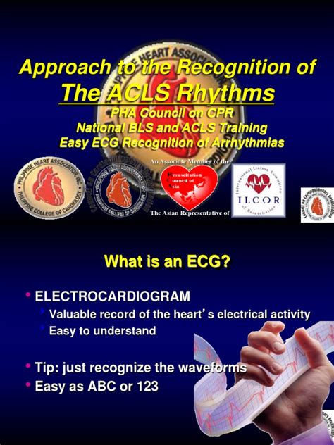 5 Arrhythmia Recognition Electrocardiography Heart