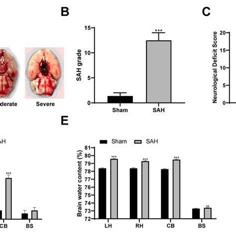 PDF Ubiquitination Of System Xc And GPX4 In Rat Brain Stimulates