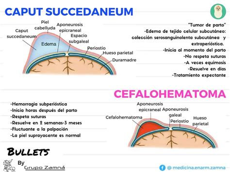 Caput Succedaneum Y Cefalohematoma Minamlismapa