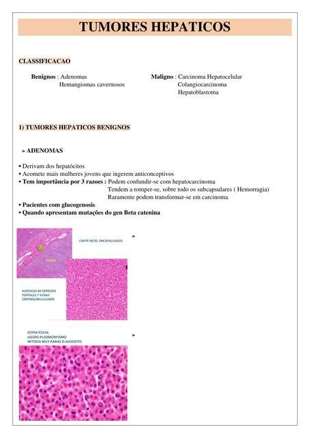 Tumores Hepáticos Asostizzo uDocz